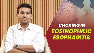 Choking In Eosinophilic Esophagitis  Dr B Padam Kumar [upl. by Frerichs]