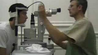 Laser Treatment for Vitreous Floaters  Patient Interview 3 [upl. by Carmelo26]