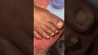 Watch me do Acrylic toe nails amp pedicure tutorial acrylicapplication acrylictoes pedicure [upl. by Attej]