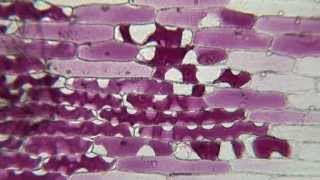 Plasmolysis of Red Onion in Sucrose [upl. by Latoyia]