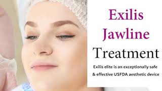 USFDA Approved BTL Exilis Jawline Treatment [upl. by Nipha]