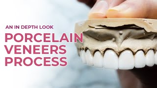 Porcelain Veneers A Dental Boutique Process  An In Depth Look [upl. by Teodor559]