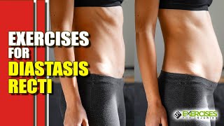 Exercises for Diastasis Recti [upl. by Verada]