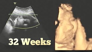 Ultrasound at 32 Week Pregnant  8 months Pregnancy Growth Scan [upl. by Olzsal49]