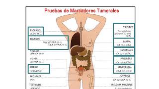 Marcadores Tumorales [upl. by Ennazor952]