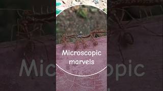 quotMicroscopic Marvels Ants Transport Preyquot [upl. by Ahsinawt455]