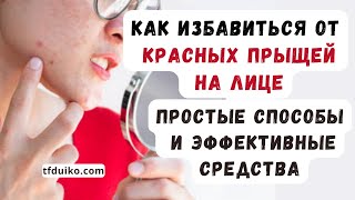 Как Избавиться от Красных Прыщей на Лице Простые Способы и Эффективные Средства [upl. by Elmina]