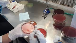 Stool Culture test procedure in Microbiology [upl. by Salvucci]