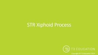 Soft Tissue Release STR xiphoid process [upl. by Namsu]