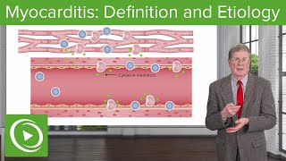 What is Myocarditis and What Causes It [upl. by Are]