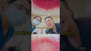 Learn How Dental Assistants Properly Exam your Teeth 🦷 dentaleducation howto [upl. by Wildon]