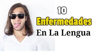 10 Enfermedades En La Lengua Imagenes [upl. by Ardene474]