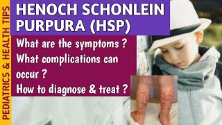 Henoch Schonlein Purpura HSP Causes Symptoms Diagnosis amp Treatment In Pediatrics [upl. by Rotciv]