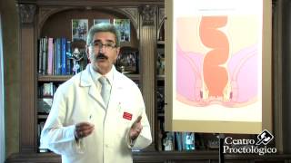 Técnicas no quirúrgicas hemorroides Escleroterapia Centro Proctológico Dr Germán Vázquez [upl. by Corsetti609]