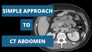 How to read a CT Abdomen  Part 2 [upl. by Matheny574]