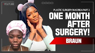 Jaylyns ethnic nose job Rhinoplasty and Facial Contouring Surgery recovery timeline  One month [upl. by Rodge]