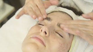 Acne Analysis And Treatment Part 2 [upl. by Benia]