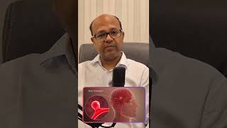 Understanding Brain Aneurysm  Dr Sumit Goyal brain aneurysm neuroscience neurologist spine [upl. by Darcey]