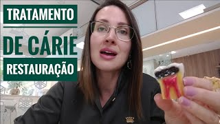 TRATAMENTO DE CÁRIE  RESTAURAÇÃO  DRA DANIELLE SALES [upl. by Nawud]