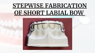 labialbow  labialboworthodontic  Short Labial Bow Fabrication  Step By Step Easy Method [upl. by Odlanra]