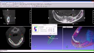 guidemia express dual scan mp4 [upl. by Jezabella]