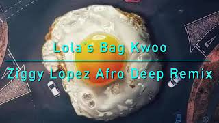 TRLER Lolas Bag Kwoo Ziggy Lopez Afro Deep Remix [upl. by Graniela494]