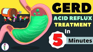 GERD Treatment  Acid Reflux Treatment  Heartburn Treatment  All You Need to Know [upl. by Meredithe868]