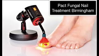 Pact Fungal Nail Treatment Birmingham [upl. by Lorolla]