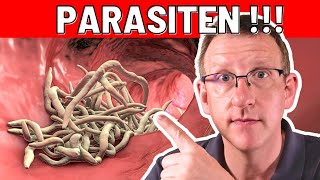 10 Frühwarnzeichen von Parasiten die sofortiges Handeln erfordern [upl. by Deroo]