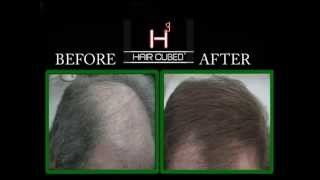 Hair Fiber  New Solution for Hair Loss [upl. by Shoshanna]