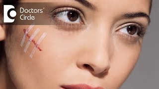 How to get rid of scars on face  Dr Aruna Prasad [upl. by Ardekan]