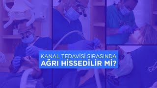 KANAL TEDAVİSİ SIRASINDA AĞRI HİSSEDER MİYİZ [upl. by Michaeline86]