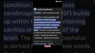 hydrocephalus [upl. by Bywoods]