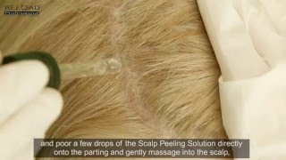 RELOAD  Step 1  Scalp Peeling [upl. by Quill]