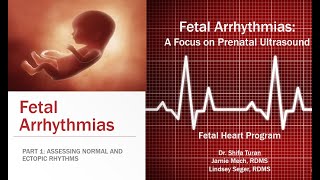 FETAL ARRHYTHMIAS Part One  Assessing Normal and Ectopic Rhythms [upl. by Strickman]