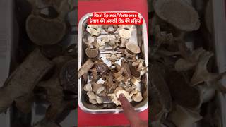 Human Real Spines  Vertebrae  रीड़ की हड्डियाँ short trending viralshorts [upl. by Deering401]