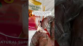 How to Use Peeling Socks for Feet  Effective Foot Care Tips shorts feet peeling [upl. by Poler]