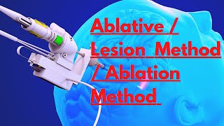 Physiological Psychology Ablative Method  Ablation Method  Lesion Method Ablative Brain Surgery [upl. by Eniahpets]