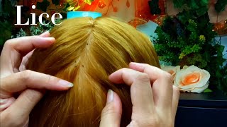 ASMR Lice Removal Pop the Lice directly on the Scalp and nails 😴💤🥱 [upl. by Sima505]