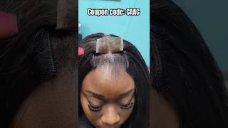 Glueless 2x6 Closure Install🔥Small Front Leave Out Tutorial Ftulahair viralshorts quickweave [upl. by Asiaj]