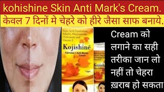 Kojishine Cream ke Fayde Kojishine Cream Uses in Hindi [upl. by Elagiba493]