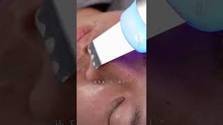 immersiveskincare blackheadremoval blackhead asmr [upl. by Trebor424]