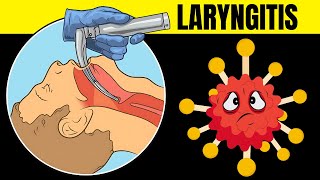 Laryngitis Acute amp Chronic  Causes Signs amp Symptoms Diagnosis And Treatment [upl. by Aldwon619]