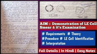 AIM  Demonstration of LE Lupus Erythematous Cell Smear amp its Examination From stained slides [upl. by Adelaida]