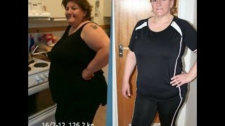 Berättar om min Gastric bypass samt bråckoperation [upl. by Oiramed]