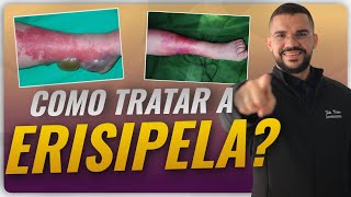 TUDO SOBRE A ERISIPELA E QUAL O MELHOR TRATAMENTO [upl. by Farman]