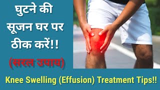 Knee Swelling  Effusion Treatment in Hindi  घुटने में सूजन का घरेलू इलाज  Knee swelling in Hindi [upl. by Hannon]