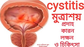 cystitis মুত্রাশয়ের প্রদাহ।মুত্রাশয়ের প্রদাহের কারন লক্ষন চিকিৎসা ঔষধ ও পরামর্শ [upl. by Brindell513]