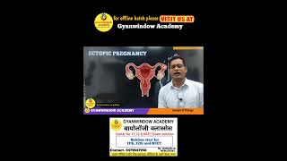 Ectopic pregnancy biology [upl. by Kenimod251]