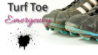 Turf Toe Emergency [upl. by Mccowyn]